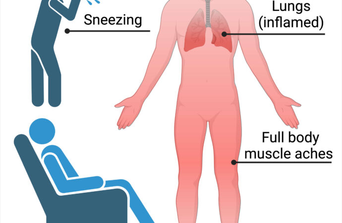 Identifying Flu Symptoms and Their Importance