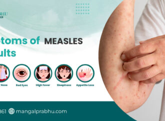 Understanding Measles Symptoms and Their Importance